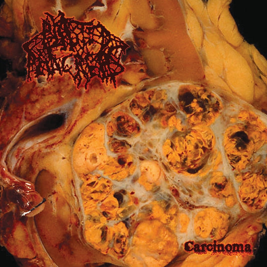 Blasted Pacreas - Carcinoma - CD - Gore House Productions